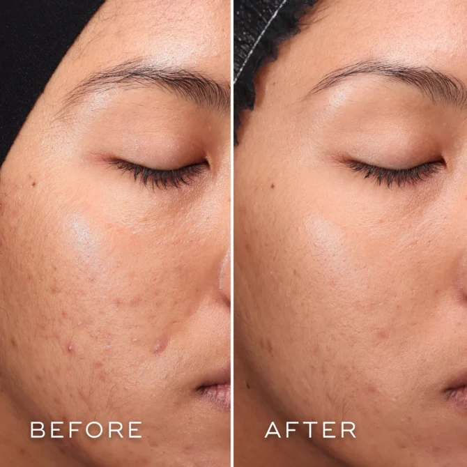 Medik8 Press & Clear